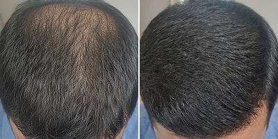 Before and After Transformation 3